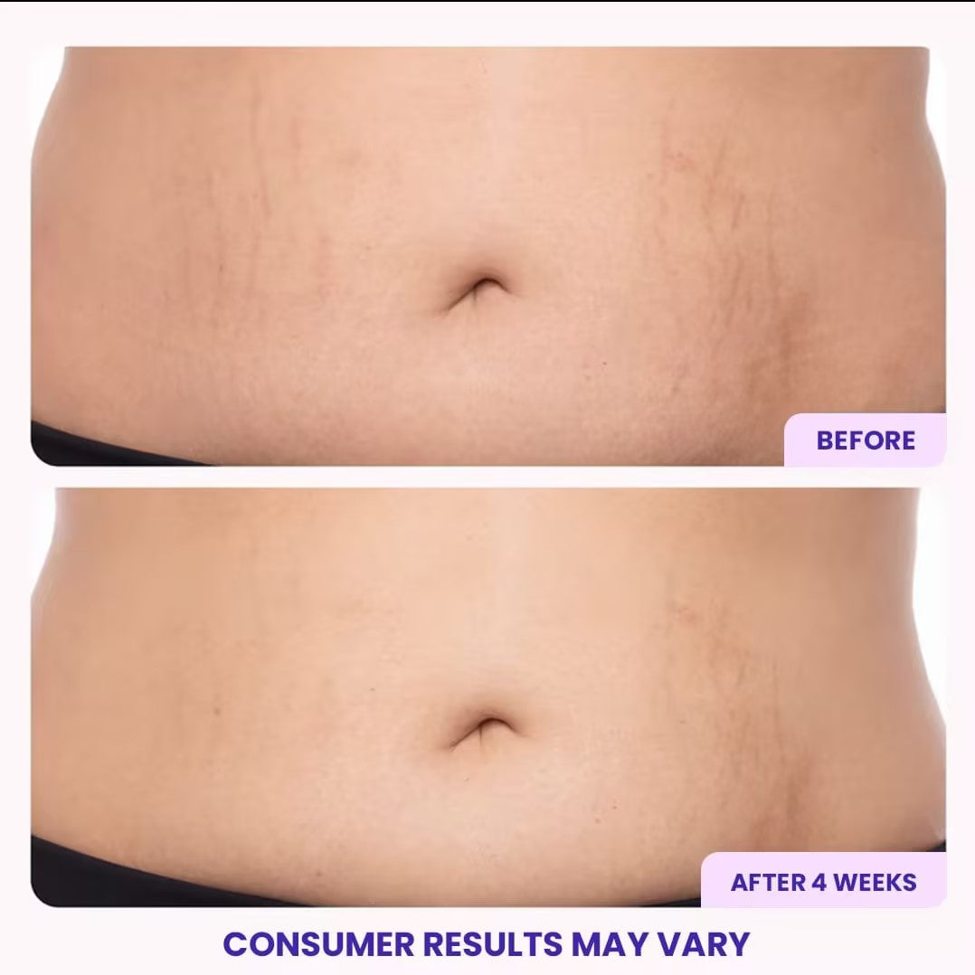 Tighten & Smooth Belly Firming Cream