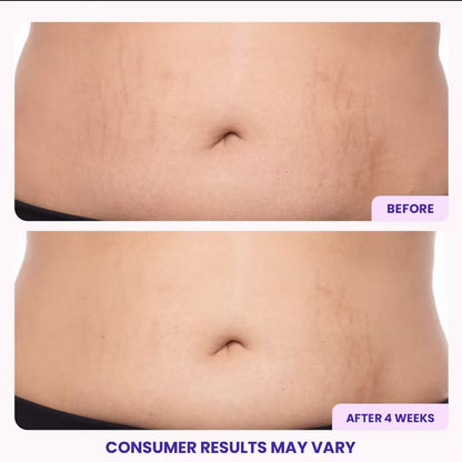 Tighten & Smooth Belly Firming Cream