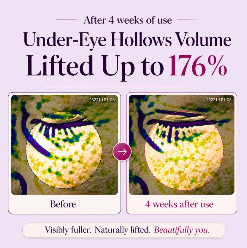 Purevivaa Calcium Dark Spot Eye Cream